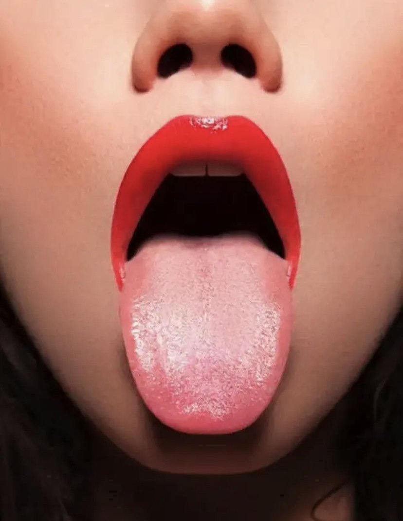 Волосатая лейкоплакия полости рта