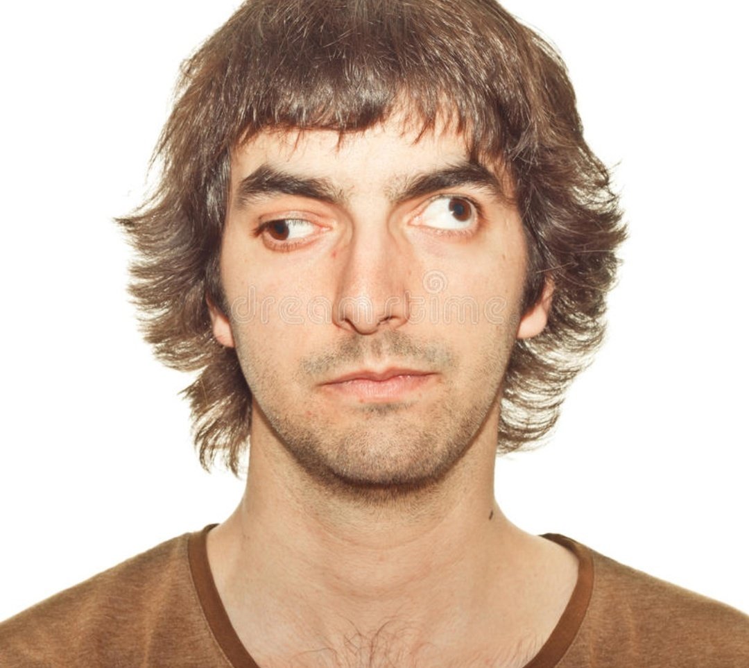 Глазы в разные стороны