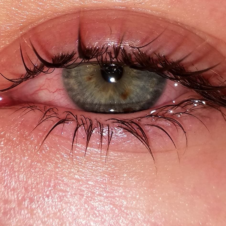 Заплаканное лицо подростка