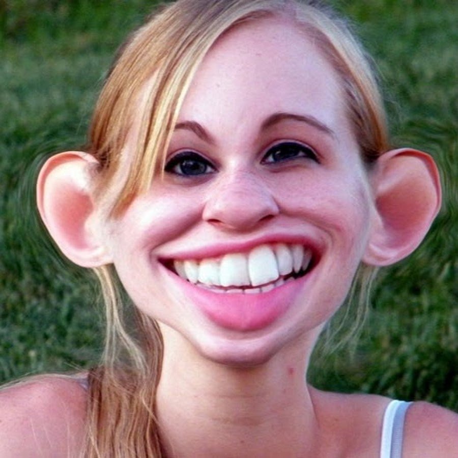 Белоснежные виниры голливудская улыбка