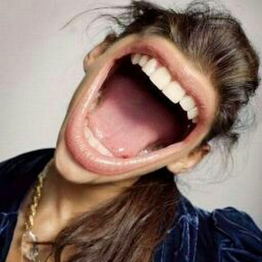 Широкая улыбка