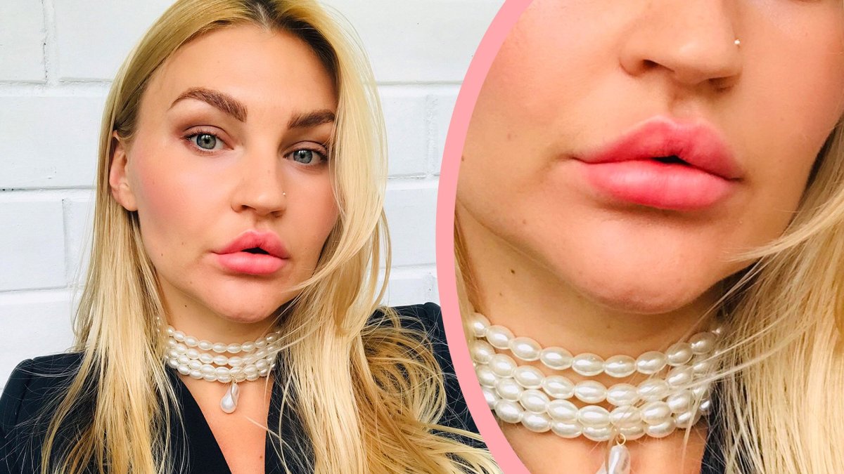 Увеличенные губы красивые