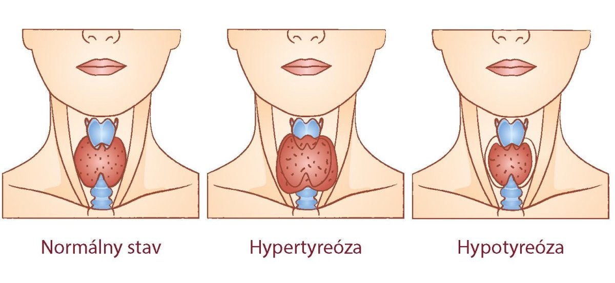 Щитовидная железа рисунок