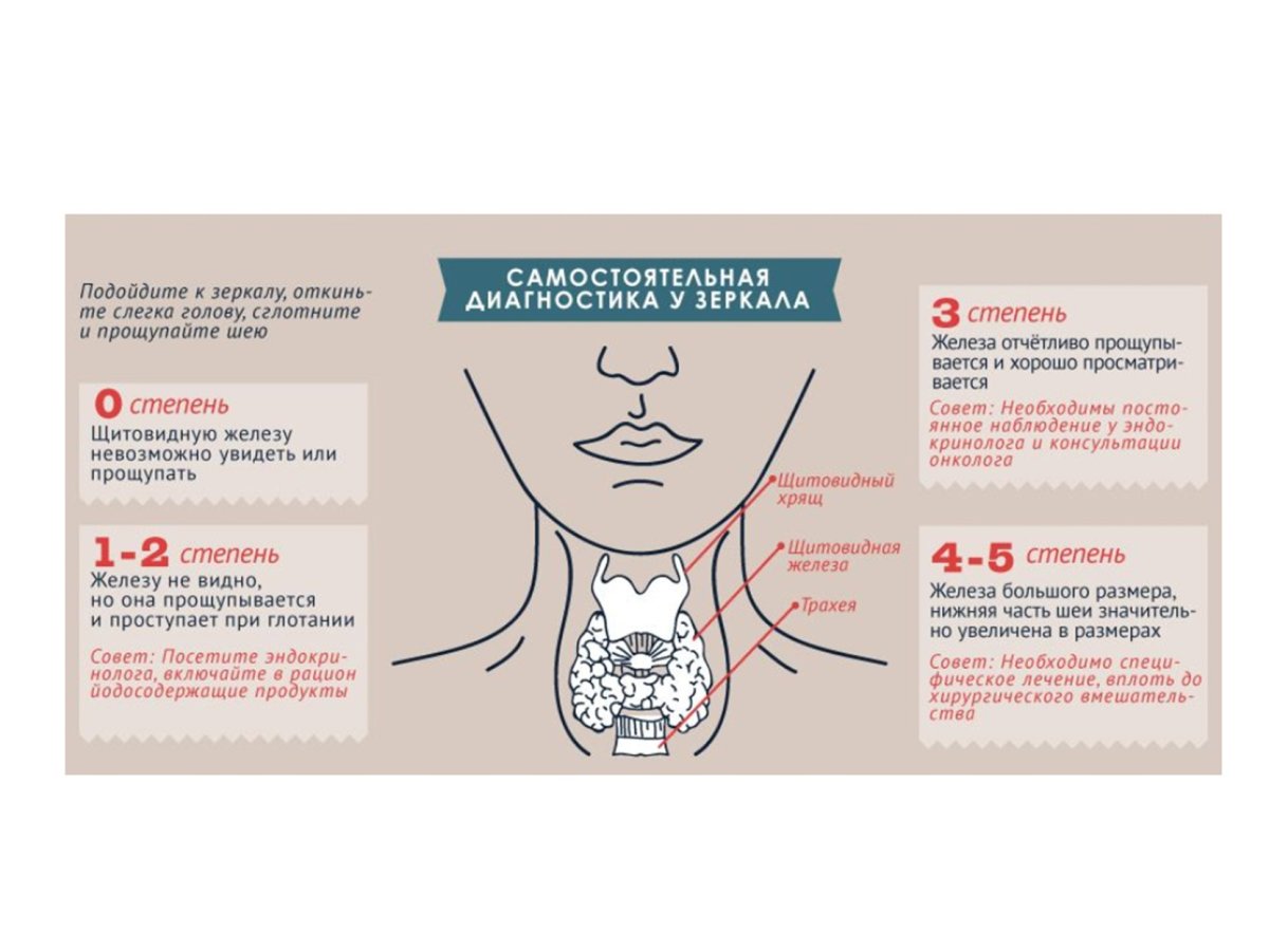 Аутоиммунный тиреоидит гипотиреоз
