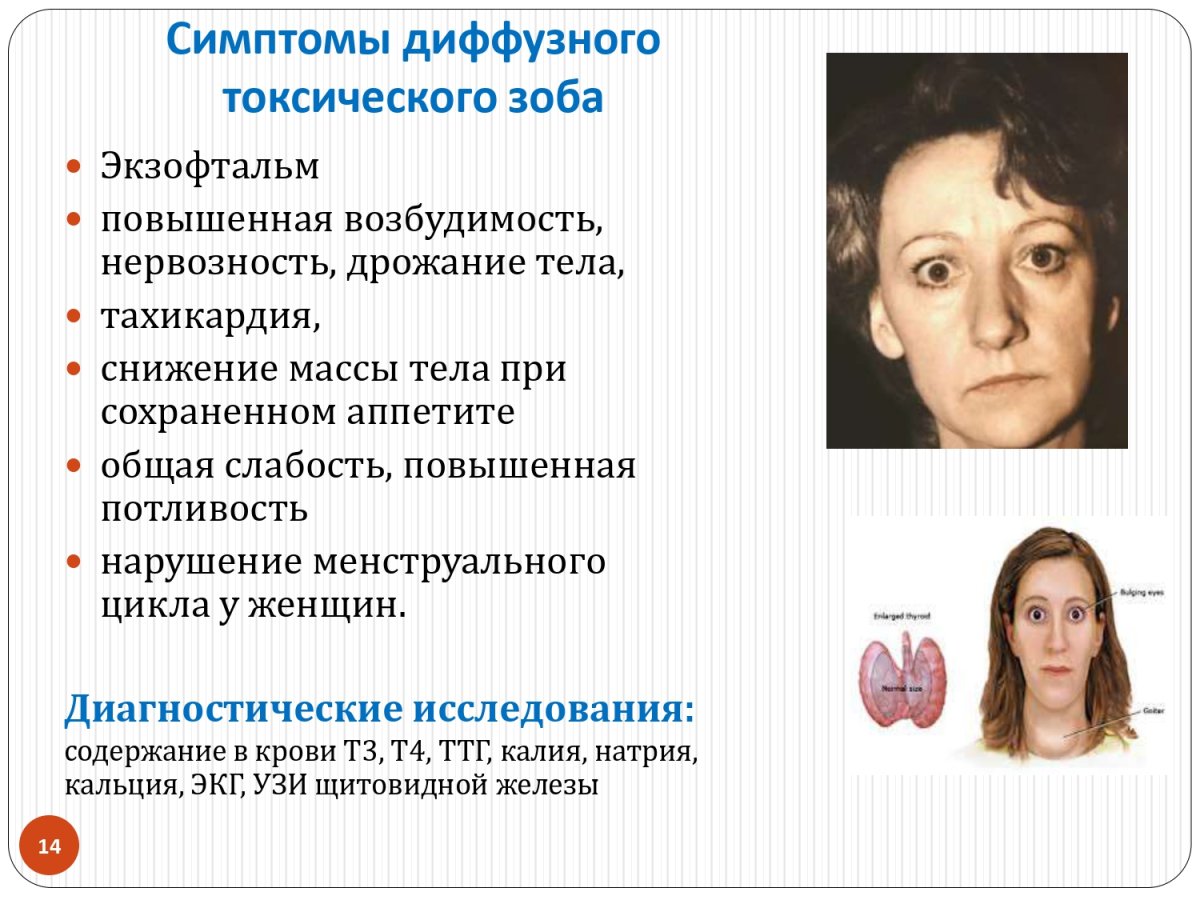 Травы при тиреотоксикозе щитовидной железы