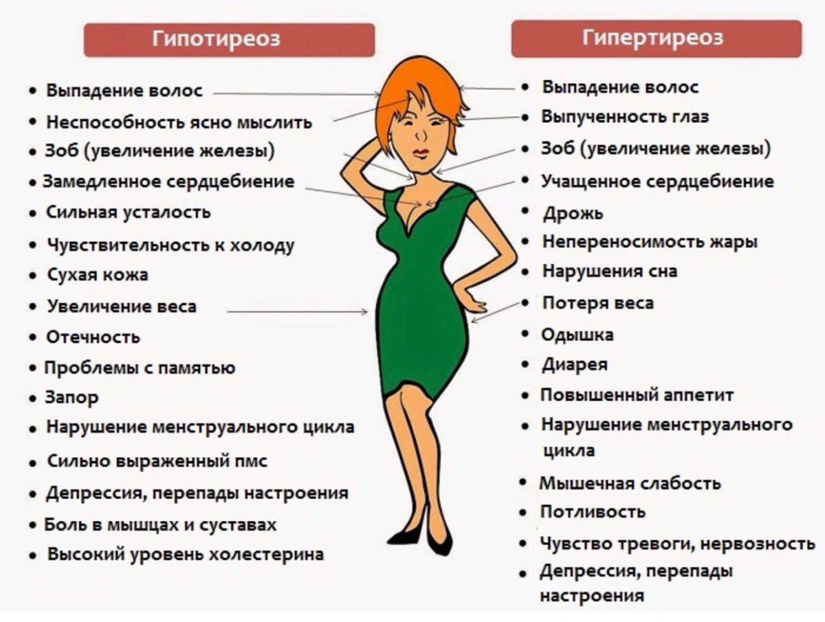 Гипертиреоз щитовидной железы