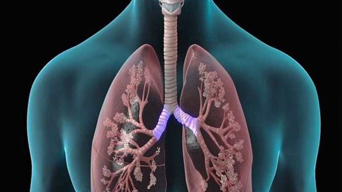 Токсический отёк лёгких