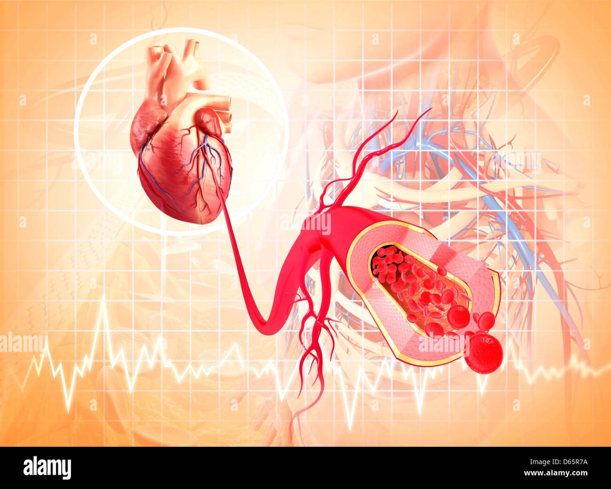 Сердечно сосудистые болезни