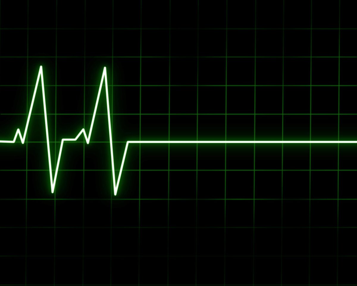 Пульс сердца