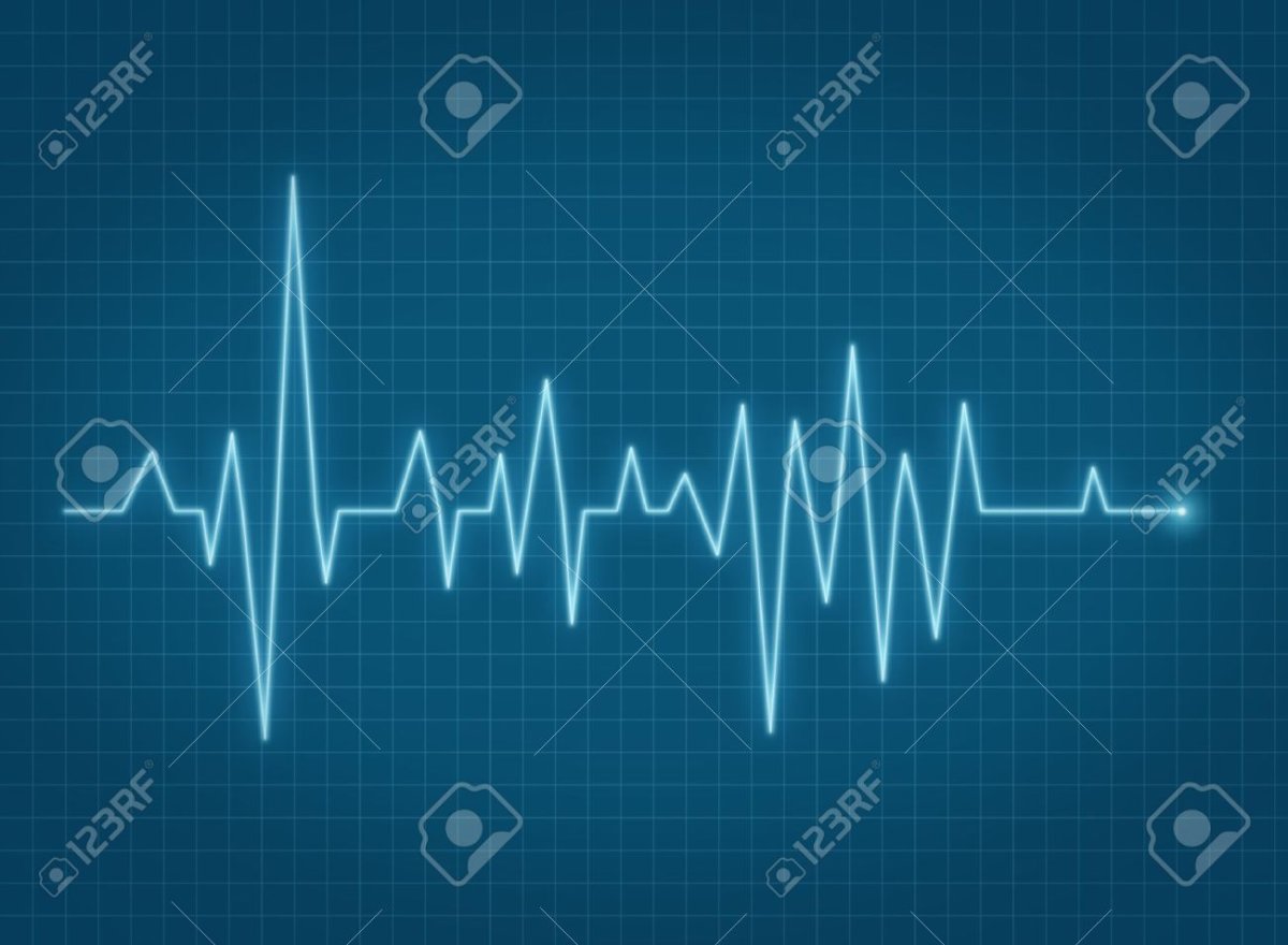 График сердцебиения