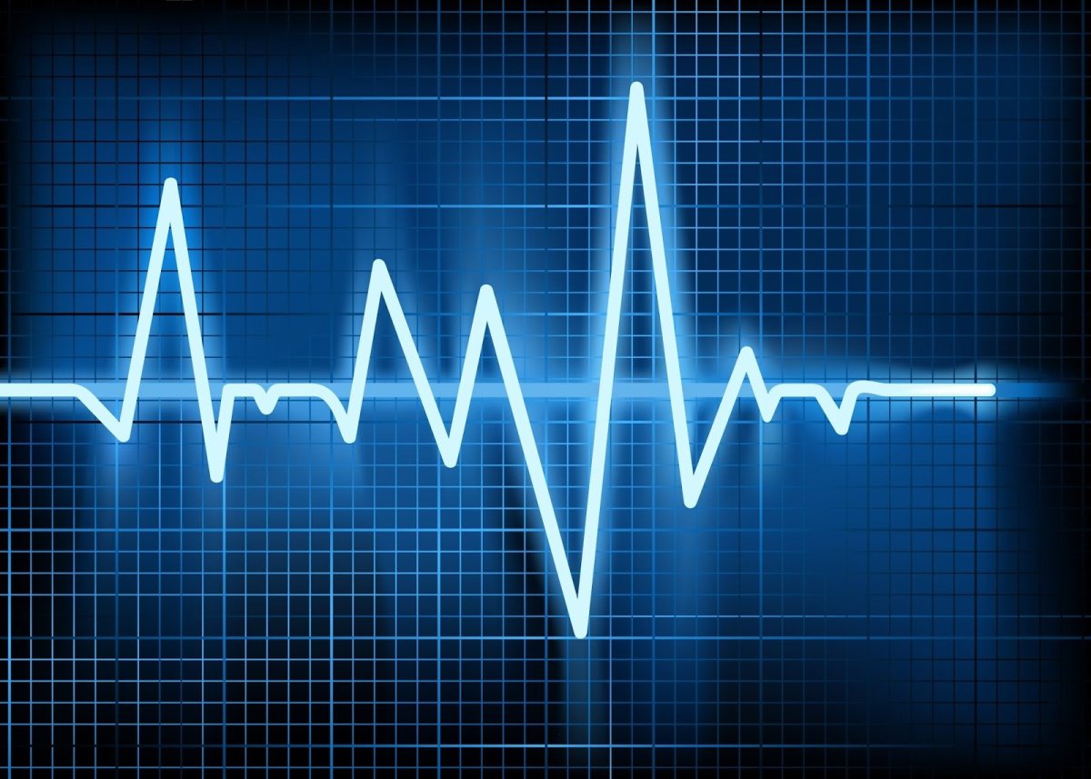 Ритм сердца