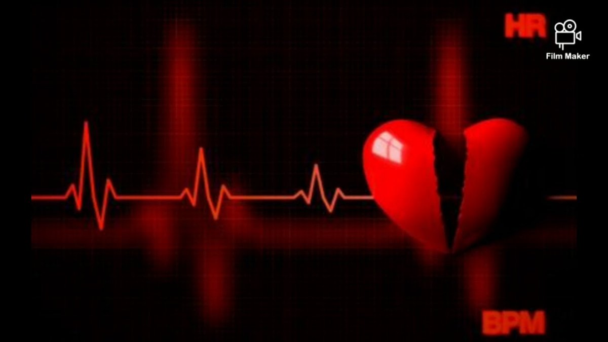 Кардиограмма остановки сердца