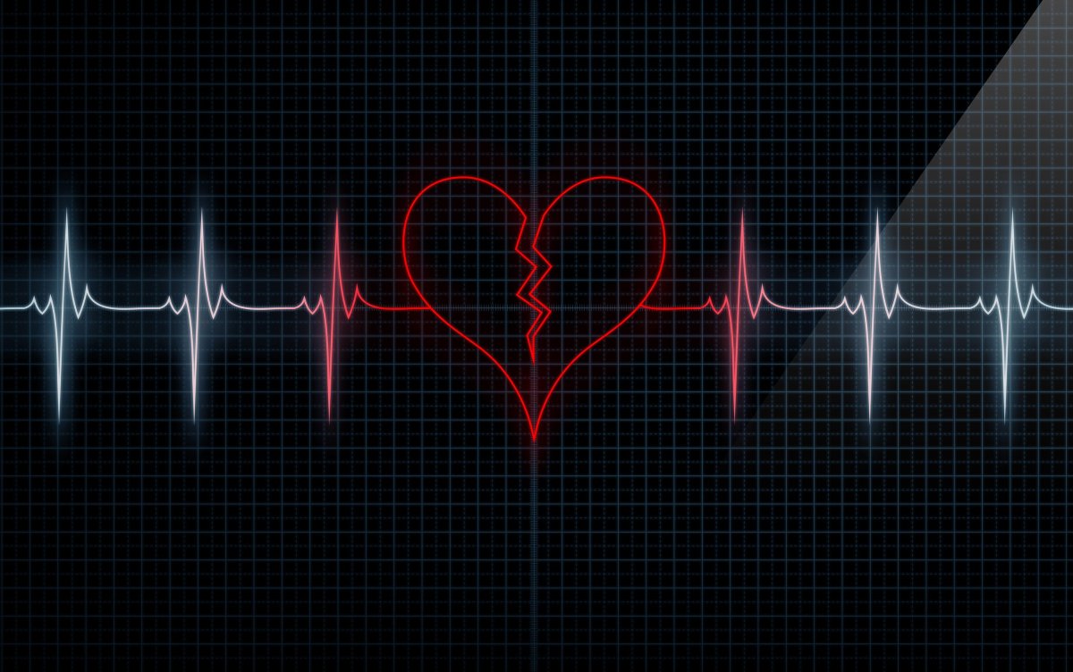 Пульс картинки