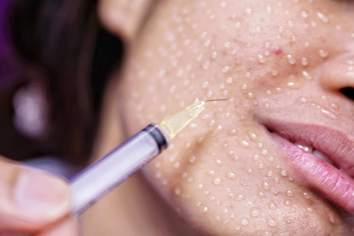 Техника наппаж мезотерапия