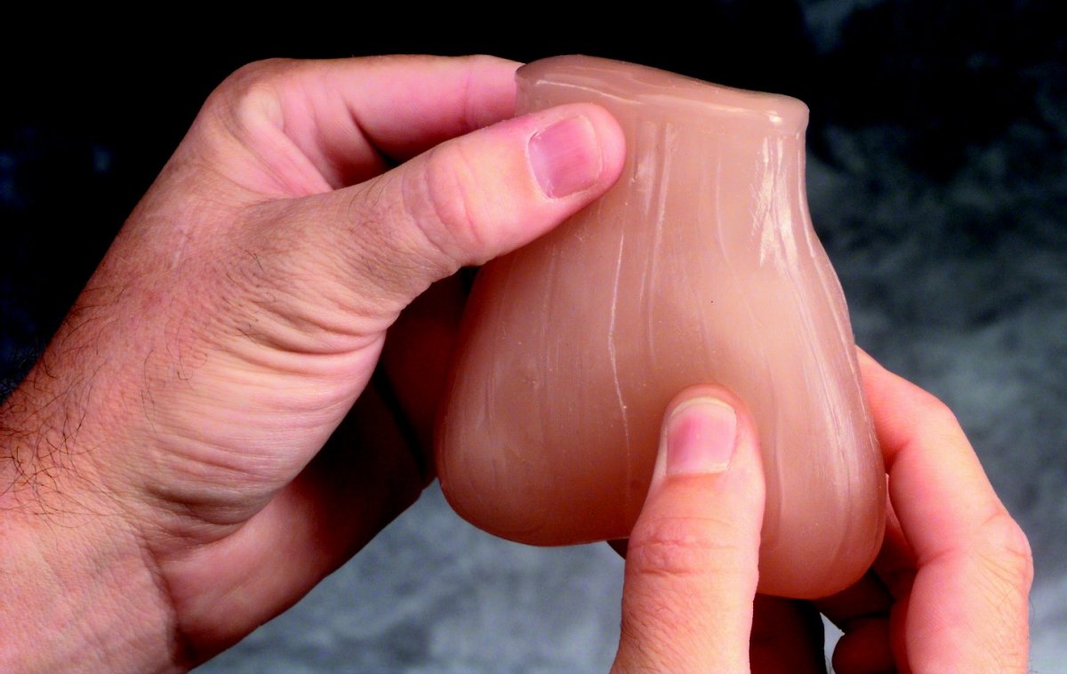 Пупковая грыжа у младенца