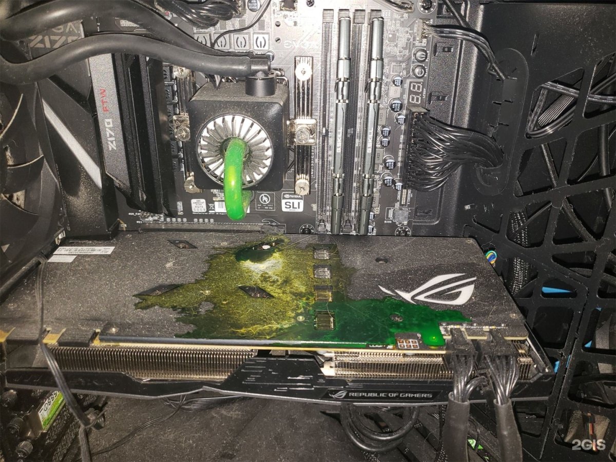 Микроцефалия гидроцефалия