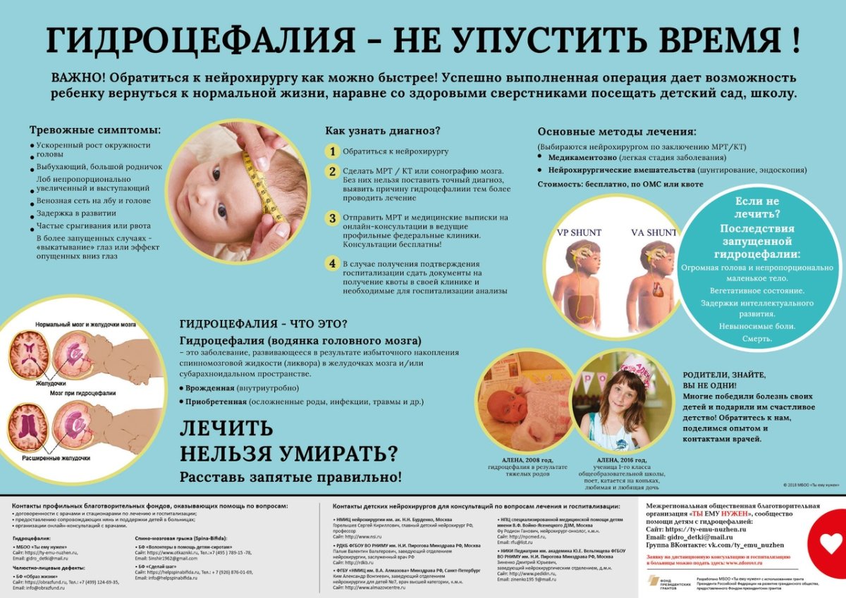 Водяное охлаждение для ПК кастом