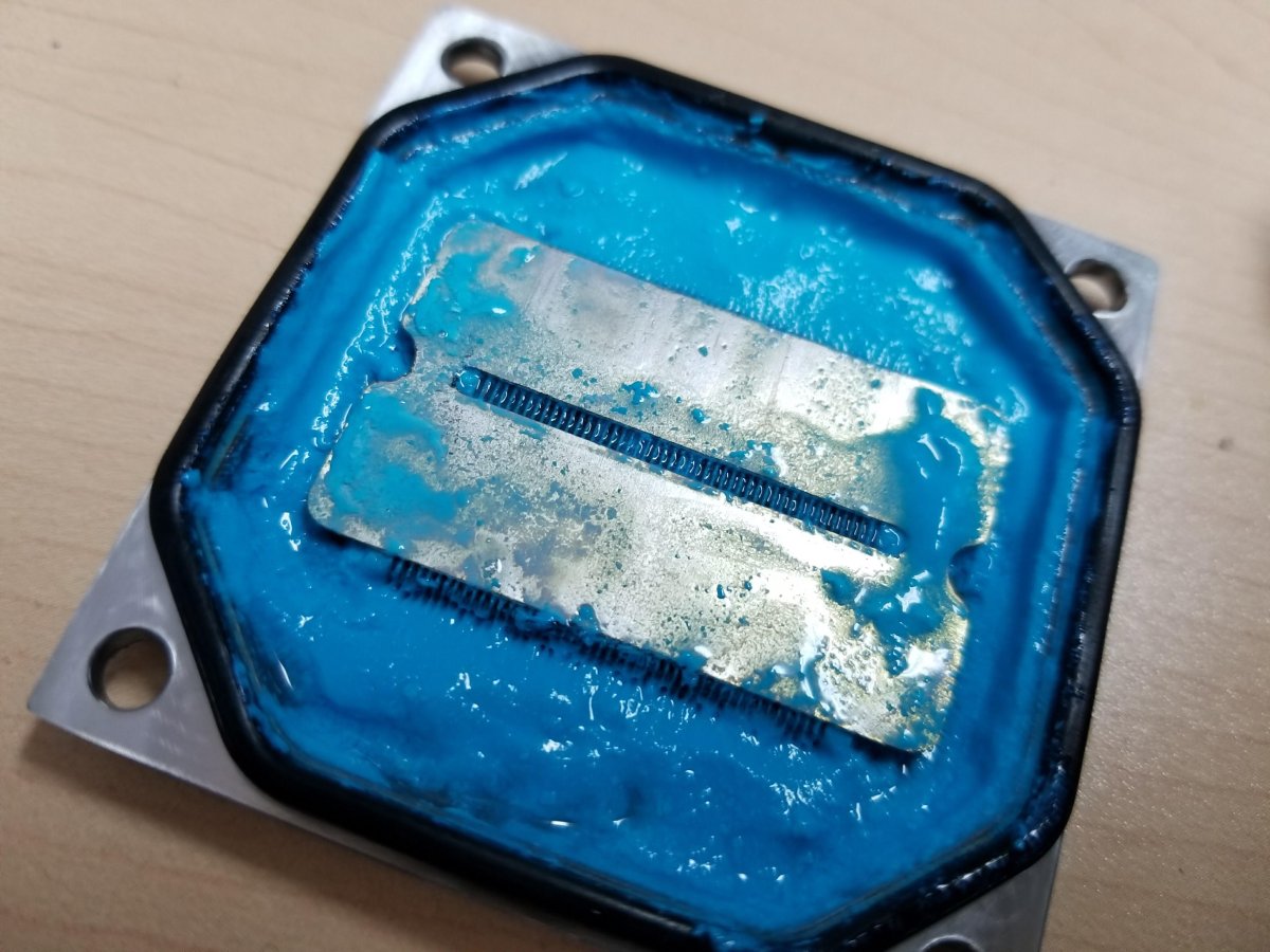 Гидроцефалия УЗИ головного мозга