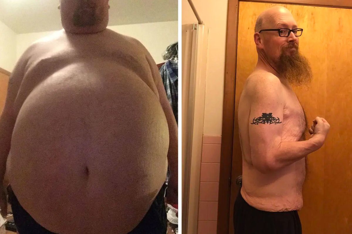 Мужчина весом 100 килограмм