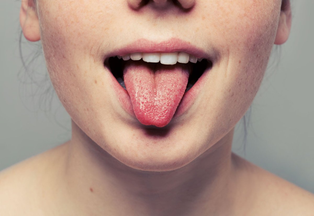 Цвет языка здорового человека