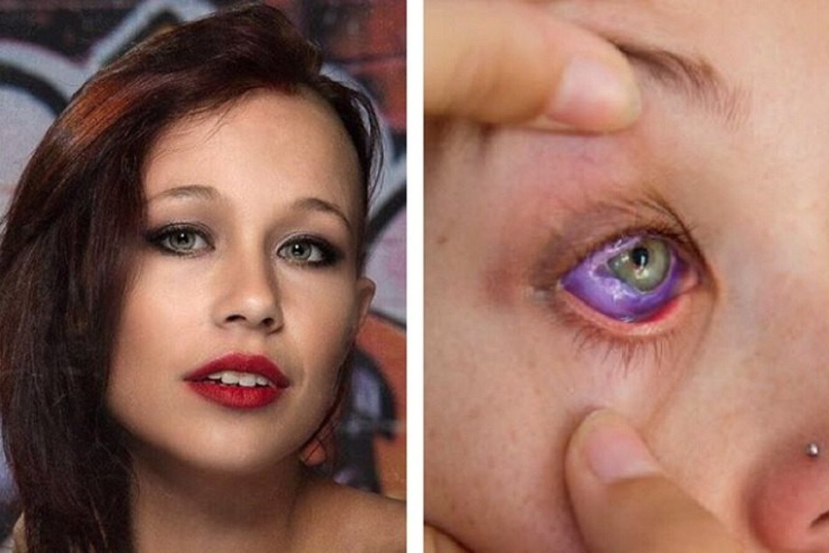 Тату на глазном яблоке неудачные