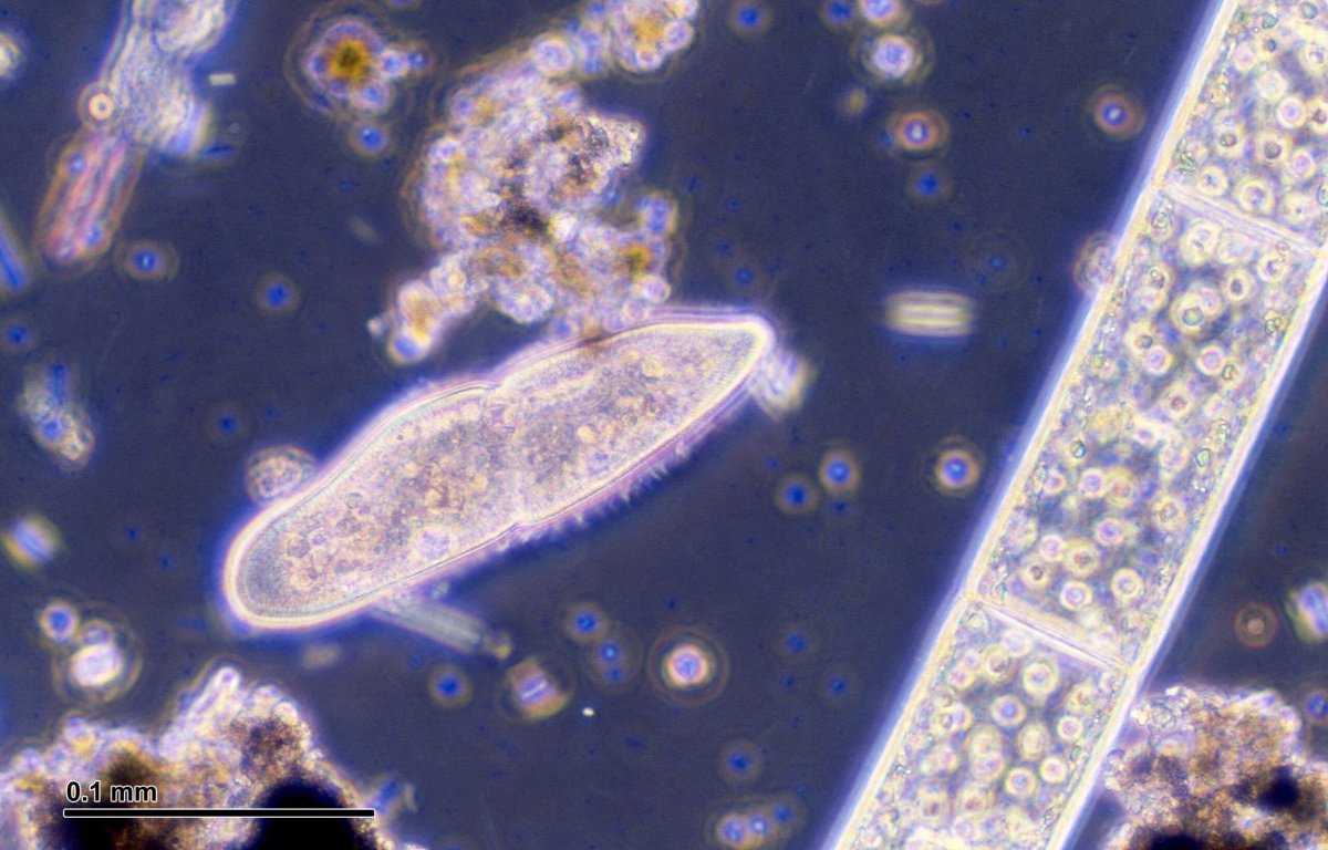 Одноклеточные инфузория туфелька